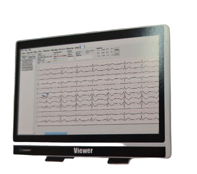 دستگاه تله کاردیوگرافی TC Viewer | می مد